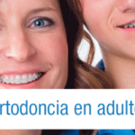 ortodoncia en adultos