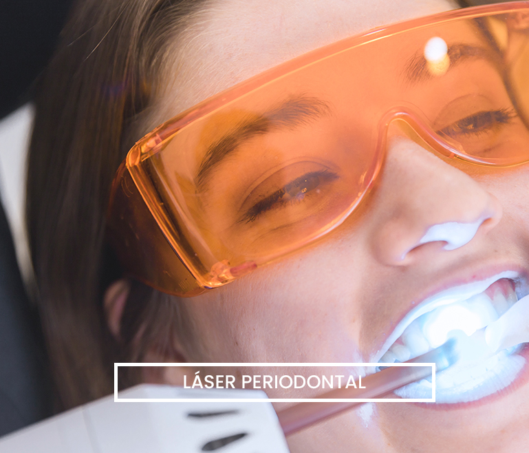 Láser periodontal | Centro González Tuñón